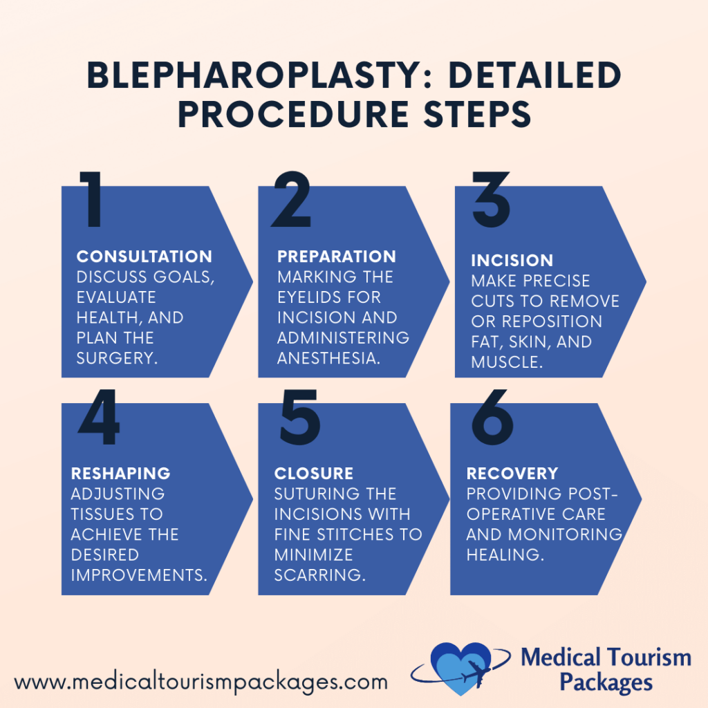 Infographic detailing six steps of blepharoplasty: consultation, preparation, incision, reshaping, closure, and recovery. Perfect for those considering an eye lift or Panama surgery to enhance their appearance and boost confidence with expert care and precision.