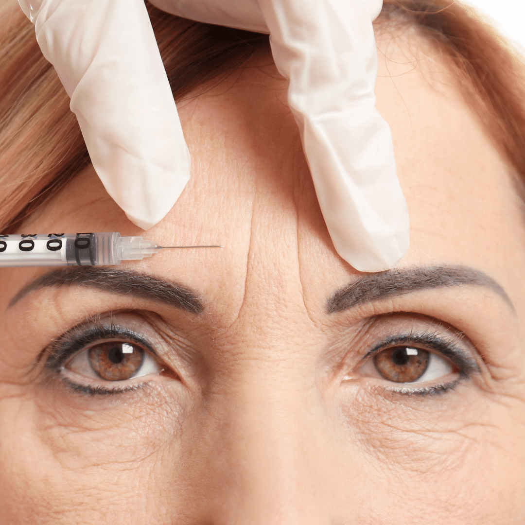 A syringe with a needle being inserted into a woman's forehead, held by a gloved hand.