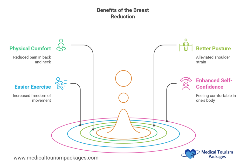 Infografía circular que muestra cuatro beneficios clave de la cirugía de reducción mamaria: comodidad física con el icono verde, ejercicio más fácil con el icono azul, mejor postura con el icono lima y mayor confianza en uno mismo con el icono rosa, cada uno conectado a un texto descriptivo y dispuesto en anillos concéntricos alrededor de un punto central.