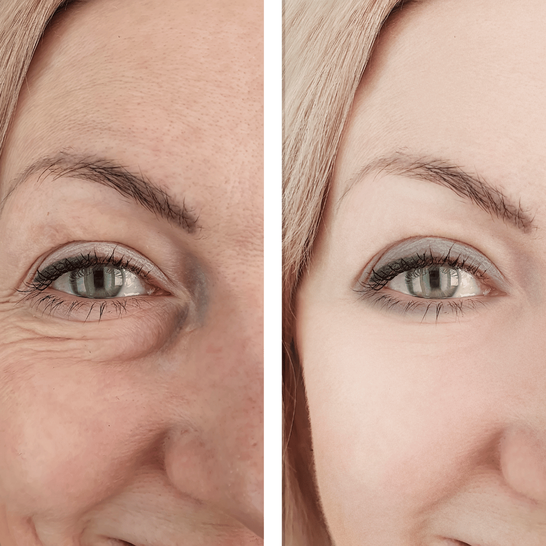 Close-up split image of a woman's face showing a comparison; the left side has wrinkles and blemishes, the right side appears smoother and more even-toned.