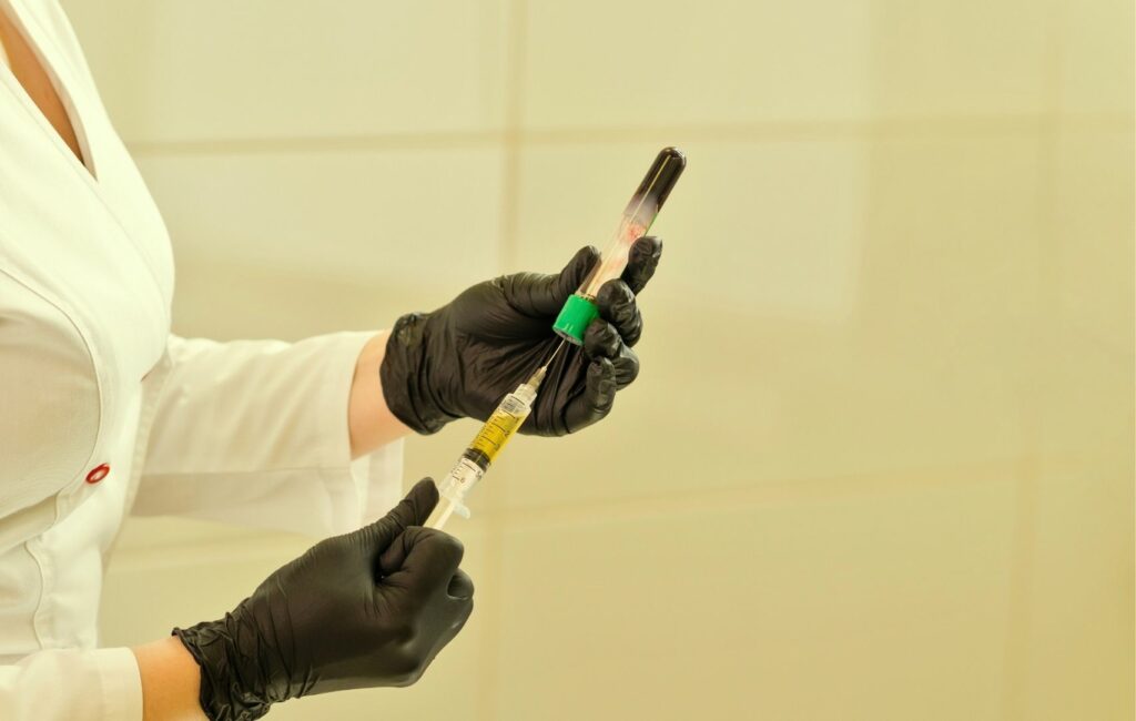 A person in a white coat and black gloves skillfully extracts liquid from a vial with a syringe, preparing for a hair restoration procedure in Panama.