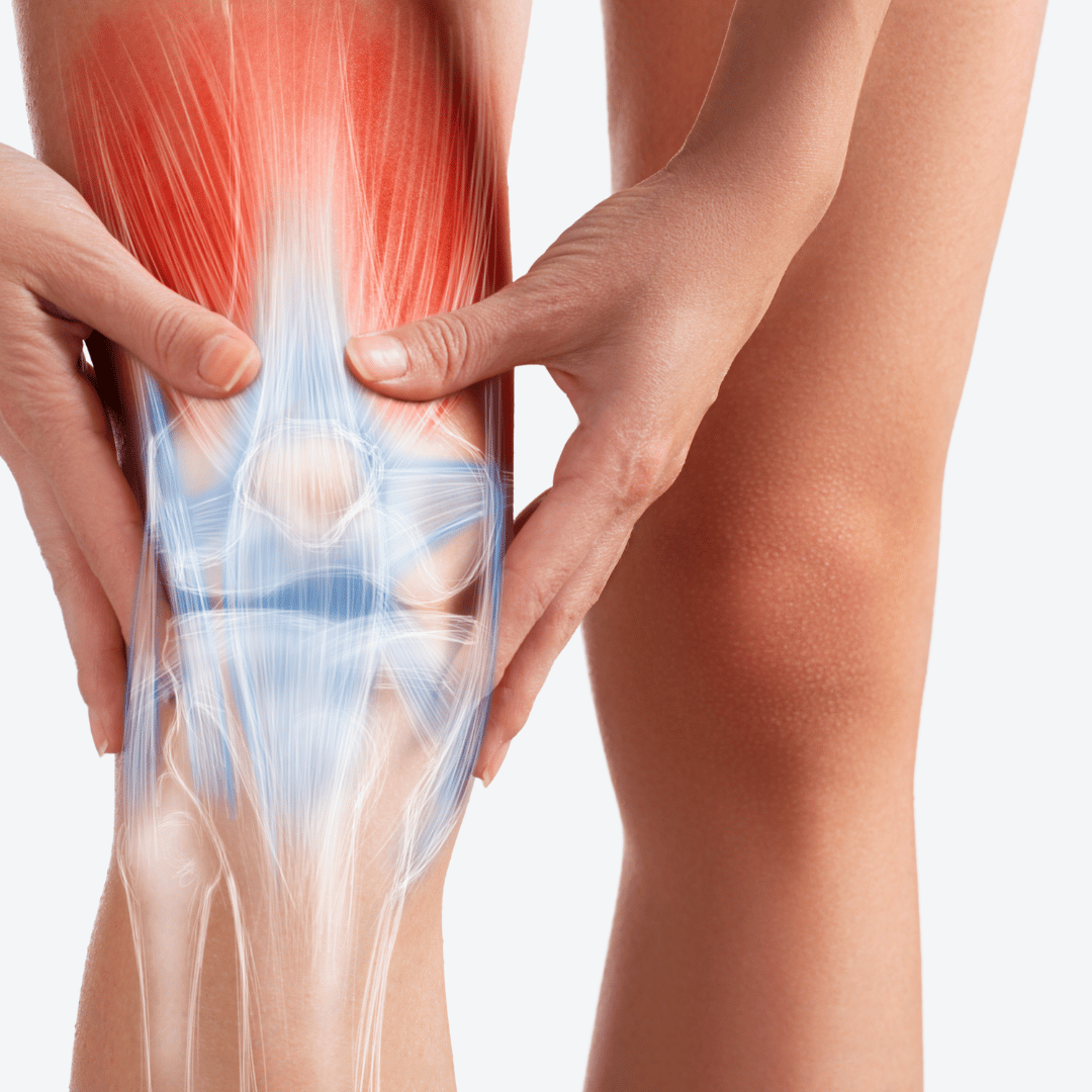 Person holding their knee with an overlay of highlighted tendons and muscles, indicating a possible focus on joint or muscular pain.