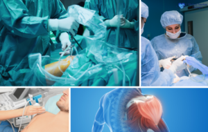 Collage of medical scenes: surgeons performing shoulder surgery, a patient receiving an ultrasound, and an anatomical diagram of a shoulder. For those considering Colombia as a medical tourism destination, this guide offers insight into the country's advanced healthcare facilities.