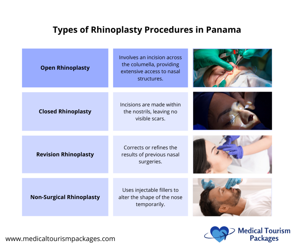 An informative chart detailing four types of rhinoplasty surgery in Panama: open, closed, revision, and non-surgical. It features brief descriptions, corresponding images for each type, and highlights the affordable precision available to those seeking these procedures.