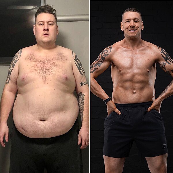 Side-by-side comparison of transformation: Left shows a man before weight loss; right, after bariatric surgery and weight loss, displays a fitter physique, smiling, and wearing athletic shorts.